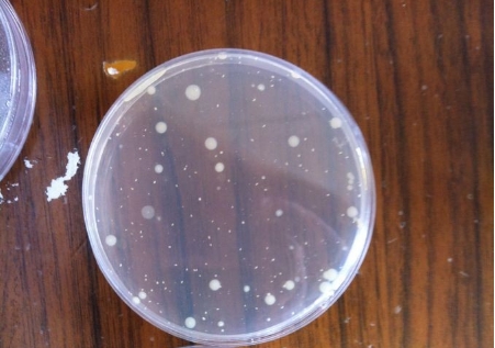 【行業(yè)干貨】從原理到實(shí)操：一文讀懂薄膜過(guò)濾法 vs 平皿法的適用邊界